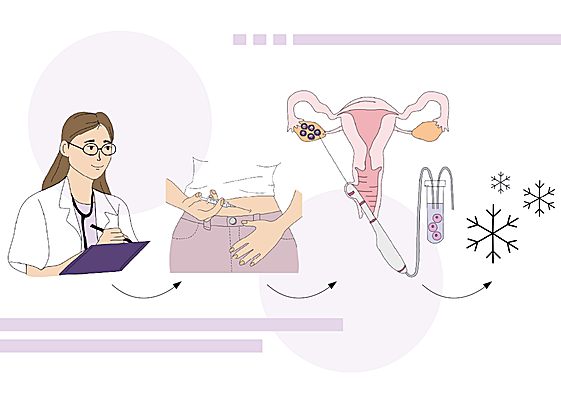 Las guipuzcoanas que congelan sus óvulos se han multiplicado por cinco en ocho años