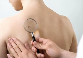 «Hay que asumir que algunas pieles no pueden broncearse de forma saludable»