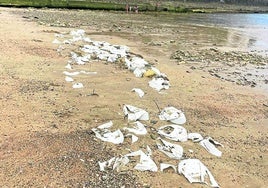 Denuncia J. D. de Robles: «Hay que salvar el pecio porque es muy ecológico. Sin embargo, este es el resultado final en la playa de Ondarreta, a fecha 7 de julio del presente año, de tan 'rigurosa y científica prospección histórica' del pasado año que interesó y, seguramente, costó tanto también».