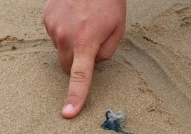 Las playas guipuzcoanas registraron ayer siete de las trece picaduras de carabela portuguesa en Euskadi