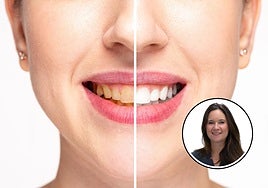 El aviso de una dentista: «Las causas de los dientes amarillos van más allá de la higiene»