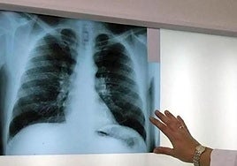 Condenan a Sidenor y CIE Legazpi a pagar 279.219 euros por daños a la familia de un fallecido por amianto