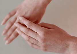 Manos secas y agrietadas