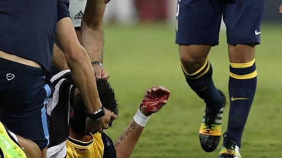 Mandzukic es atendido después de sufrir el golpe que le causó la fractura nasal. 