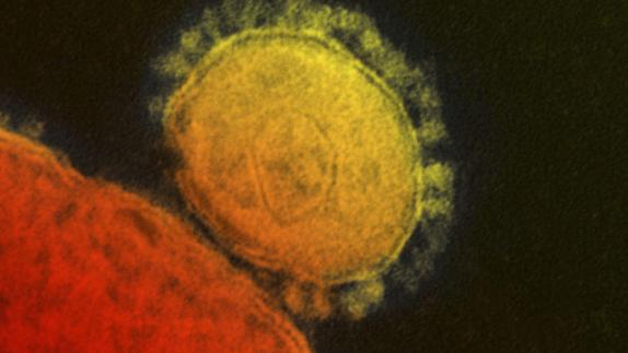 Micrografías electrónicas del Síndrome respiratorio por coronavirus de Oriente Medio.