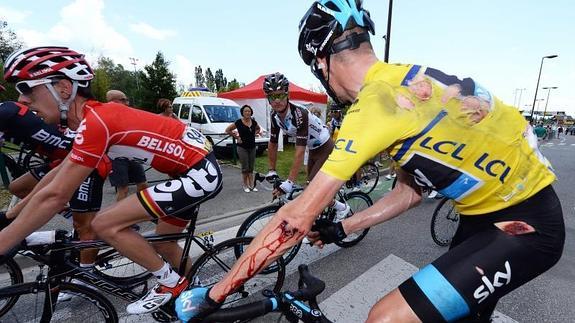 Froome, con las heridas producidas por la caída. 