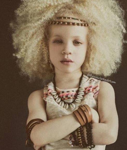 Ava Clarke, la niña albina que ya triunfa como modelo | El Diario Vasco