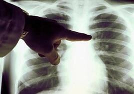 Imagen de una radiografía.