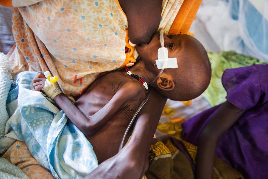 Mortal crisis alimentaria en Sudán del Sur