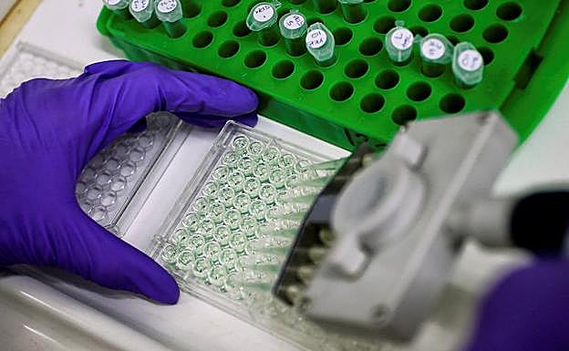 Un científico prepara un análisis de proteínas. 