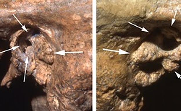 Estudio del Shanidar 1.