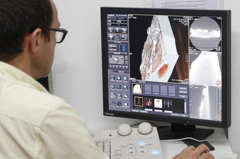 Un equipo de científicos del Museo del Jurásico de Asturias se han desplazado a un hospital veterinario de Gijón para escanear huesos de dinosaurios fosilizados. El objetivo es hacer una reconstrucción en tres dimensiones de los mismos, así como estudiar la posibilidad de sacar los restos de las rocas. 