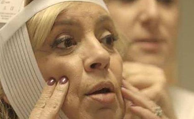 Última hora de Carmen Borrego y su operación de papada