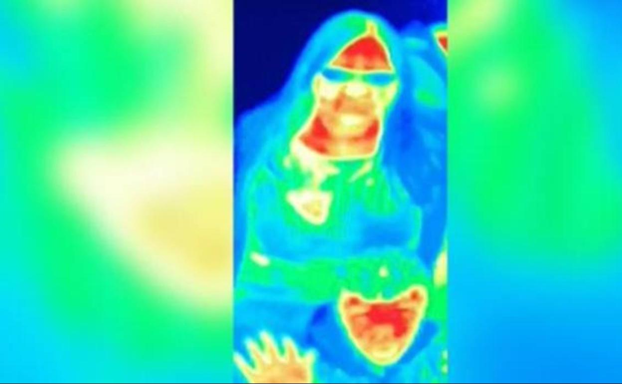 Imagen con la que Bal Gill sospechó y pidió cita con su médico.