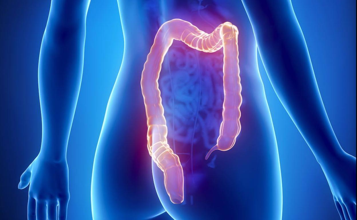 La dieta que reduce a la mitad el riesgo de cáncer de colon