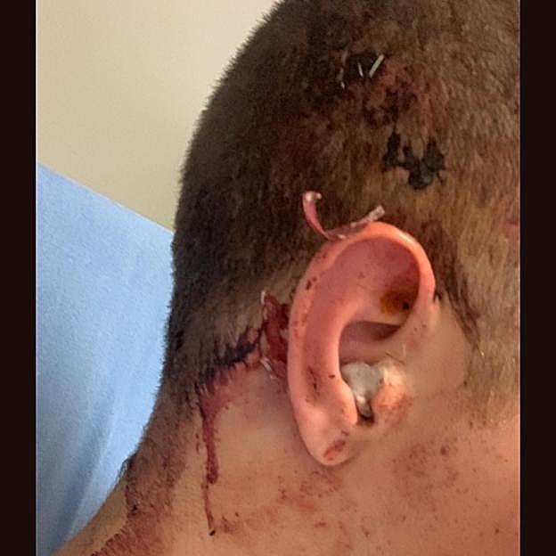 Estado del joven tras la agresión de este fin de semana en Oviedo. 