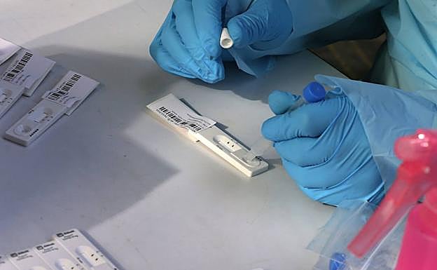 ¿Cuánto cuesta una prueba de antígenos y cuándo hay que hacérsela?