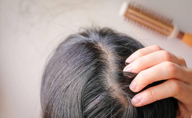 Son varias las causas que pueden provocar la alopecia femenina 