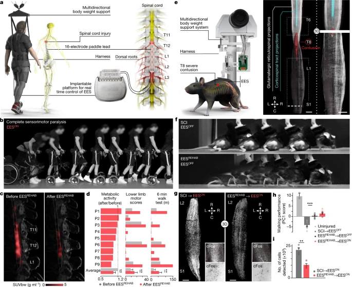 Kinesia Terapia Física y Rehabilitación - La electro estimulación