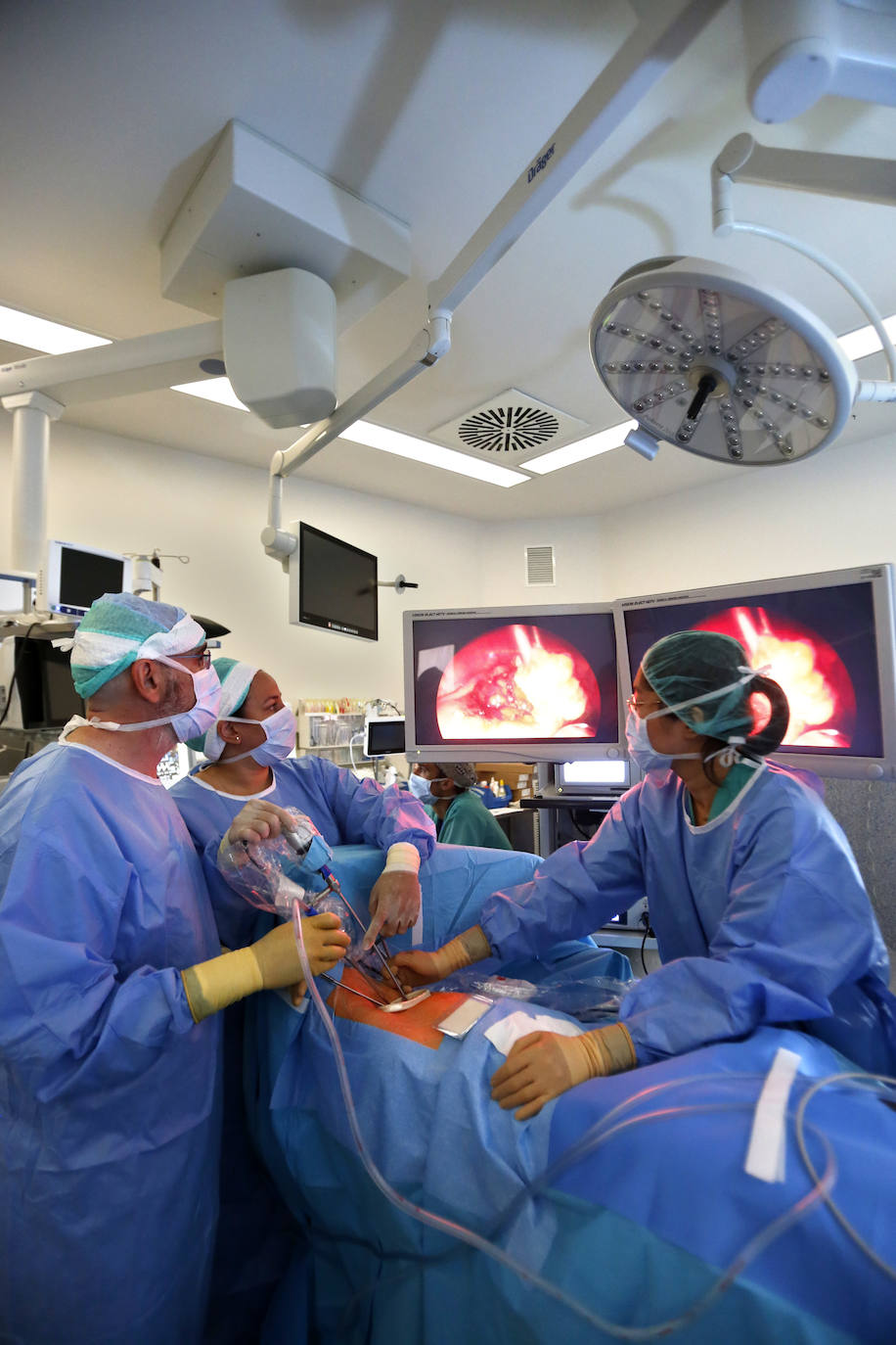 Especialistas en cirugía torácica del HUC A, en plena intervención quirúrgica.