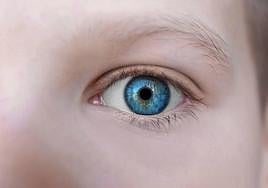 Hay cuatro tipos diferentes de conjuntivitis.