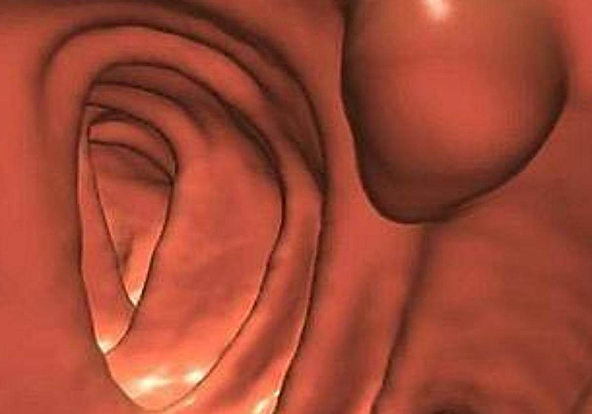 Imagen de una colonoscopia generada por ordenador.