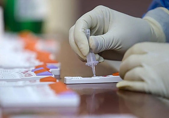 Test para detectar anticuerpos de covid-19.