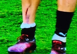 Así quedó la pierna derecha de Kevin, que fue amonestado, tras la dura entrada de Thalys.