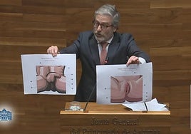 Jové, mostrando las ilustraciones de los genitales, durante su intervención en el Pleno.