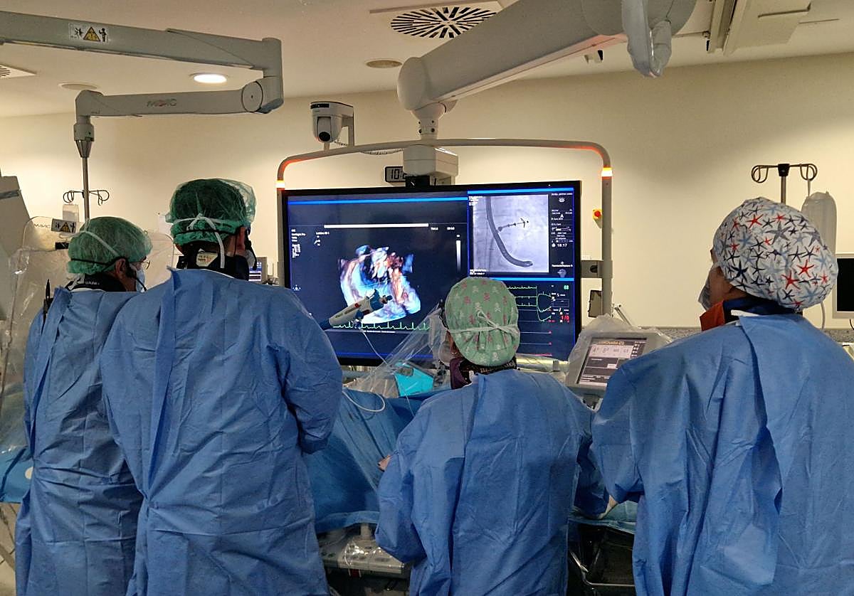 El equipo del HUCA, en plena intervención con la nueva herramienta.