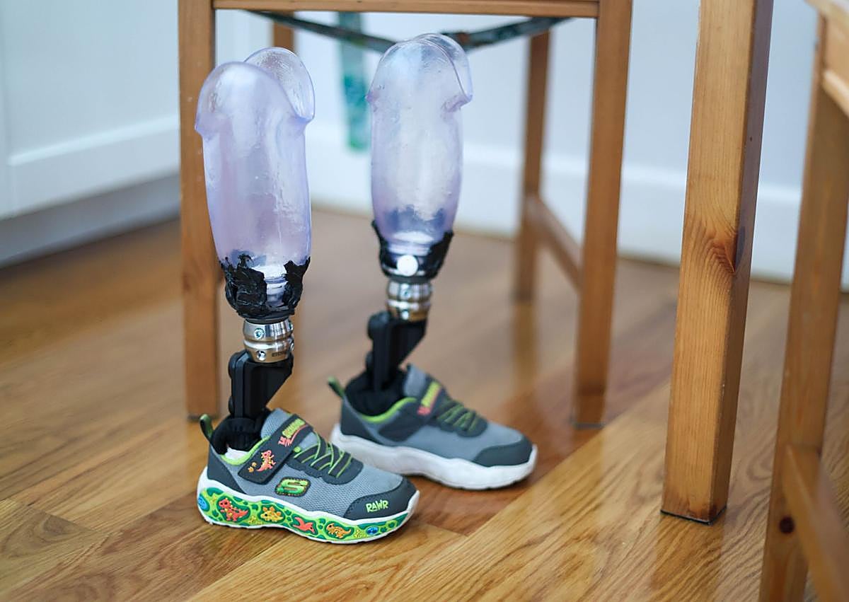 Imagen secundaria 1 - Mael, el niño que venció a un dragón llamado Meningococo