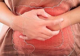 Una nueva variante del norovirus es la responsable del incremento de brotes de gastroenteritis de los últimos años.