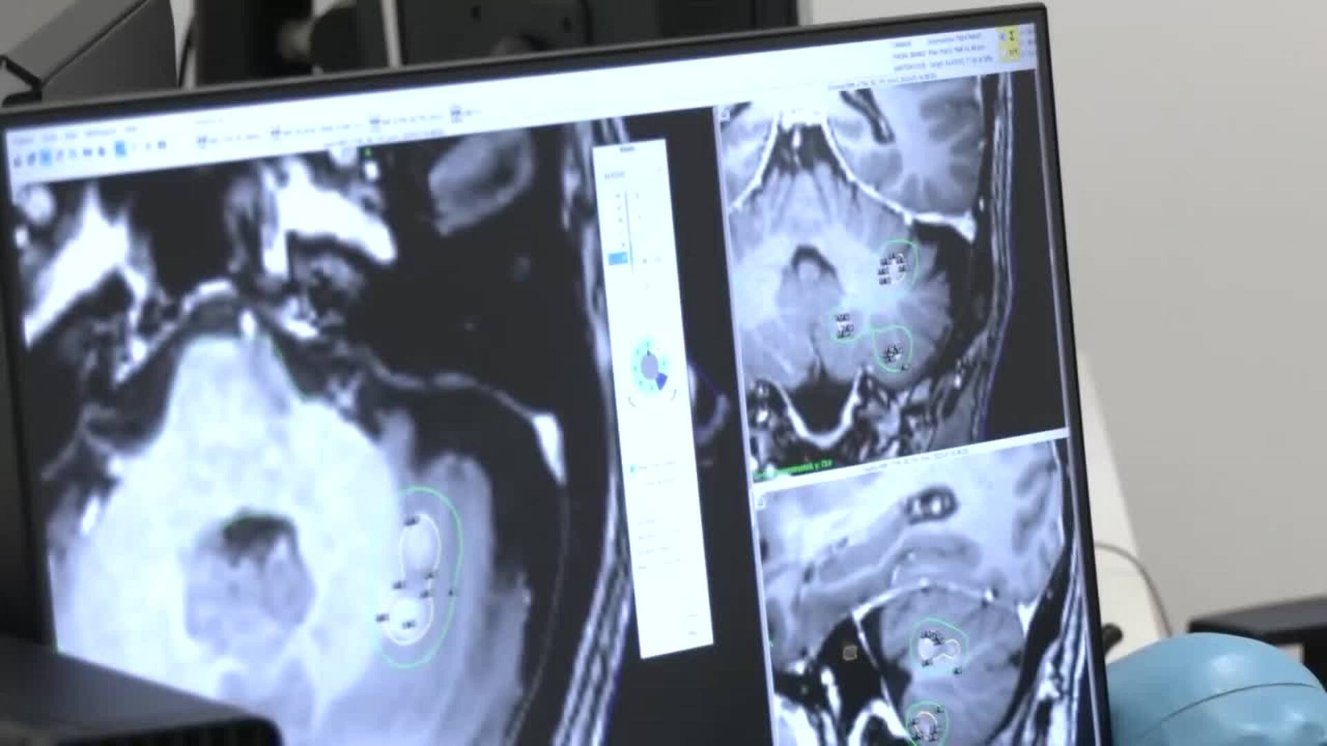 La Fiscalía de Sevilla archiva la denuncia de Amama por "supuesta desaparición" de mamografías