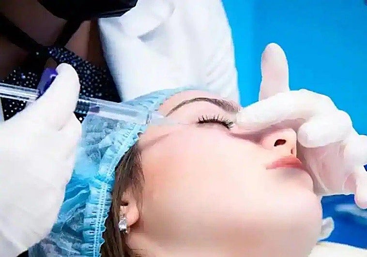 La tendencia en retoques estéticos: más ácido hialurónico y colágeno, y menos bótox para «que no se noten»