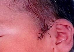 Al bebé le dieron 16 puntos: 11 externos y cinco internos. / RC