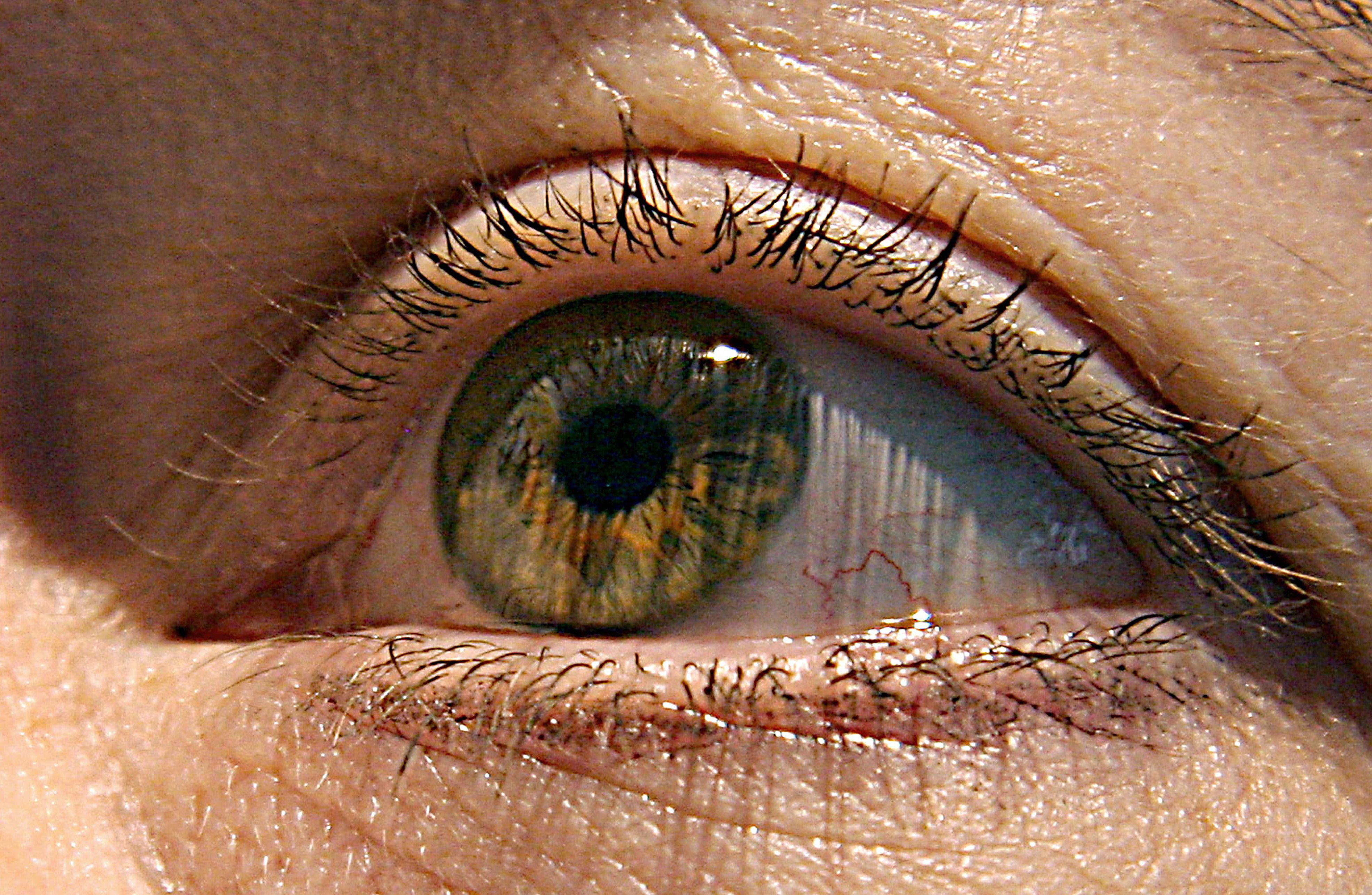 La décima parte de los diabéticos sufren edema macular