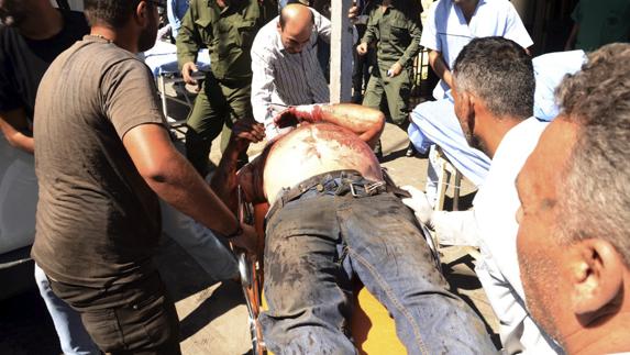 Un hombre herido es trasladado a un hospital de Alepo.