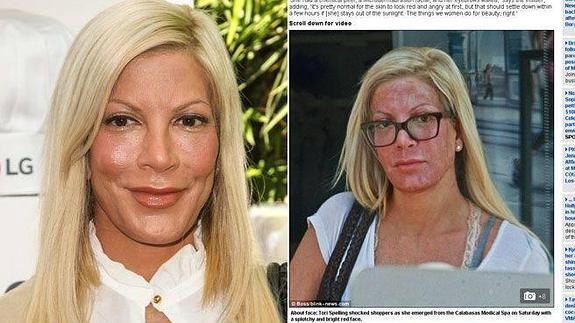 El espeluznante cambio cara de Tori Spelling 