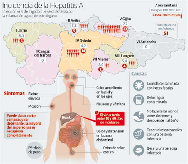 51 casos de hepatitis A en cuatro meses en Asturias