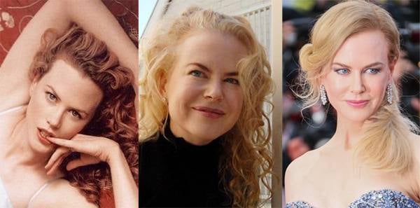 Nicole Kidman.