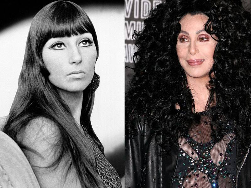 Cher, antes y después de operarse. 