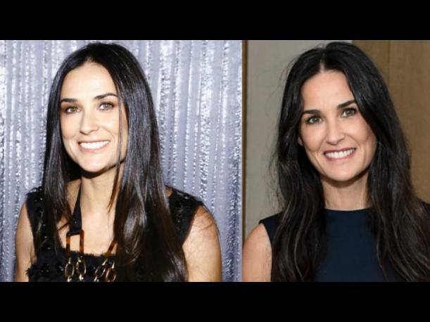 Demi Moore, antes y después de operarse.. 