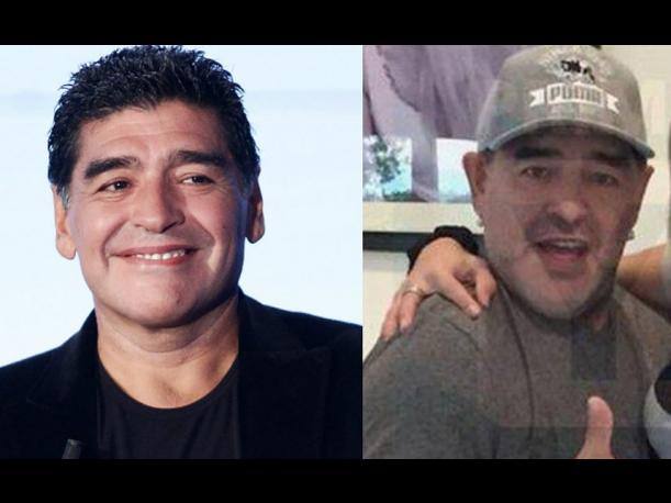 Maradona, antes y después de operarse.. 