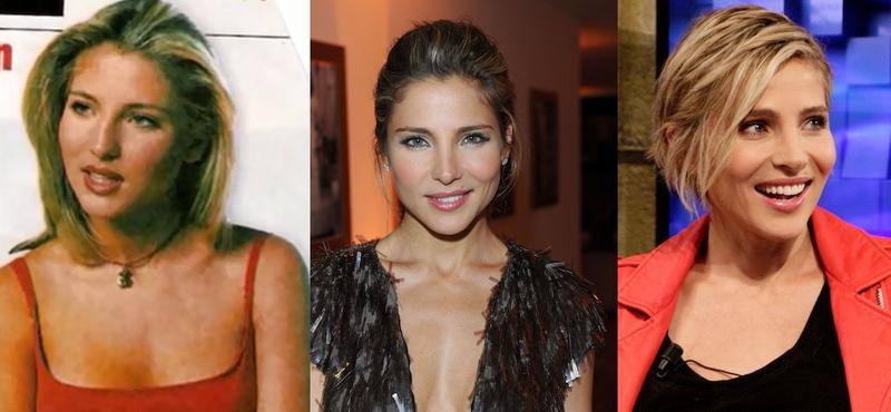 Elsa Pataky, antes y después de operarse. 