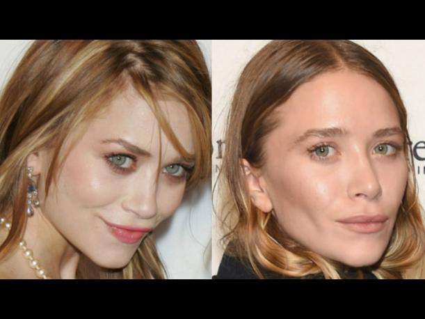 Mary Kate Olsen, antes y después de operarse. 