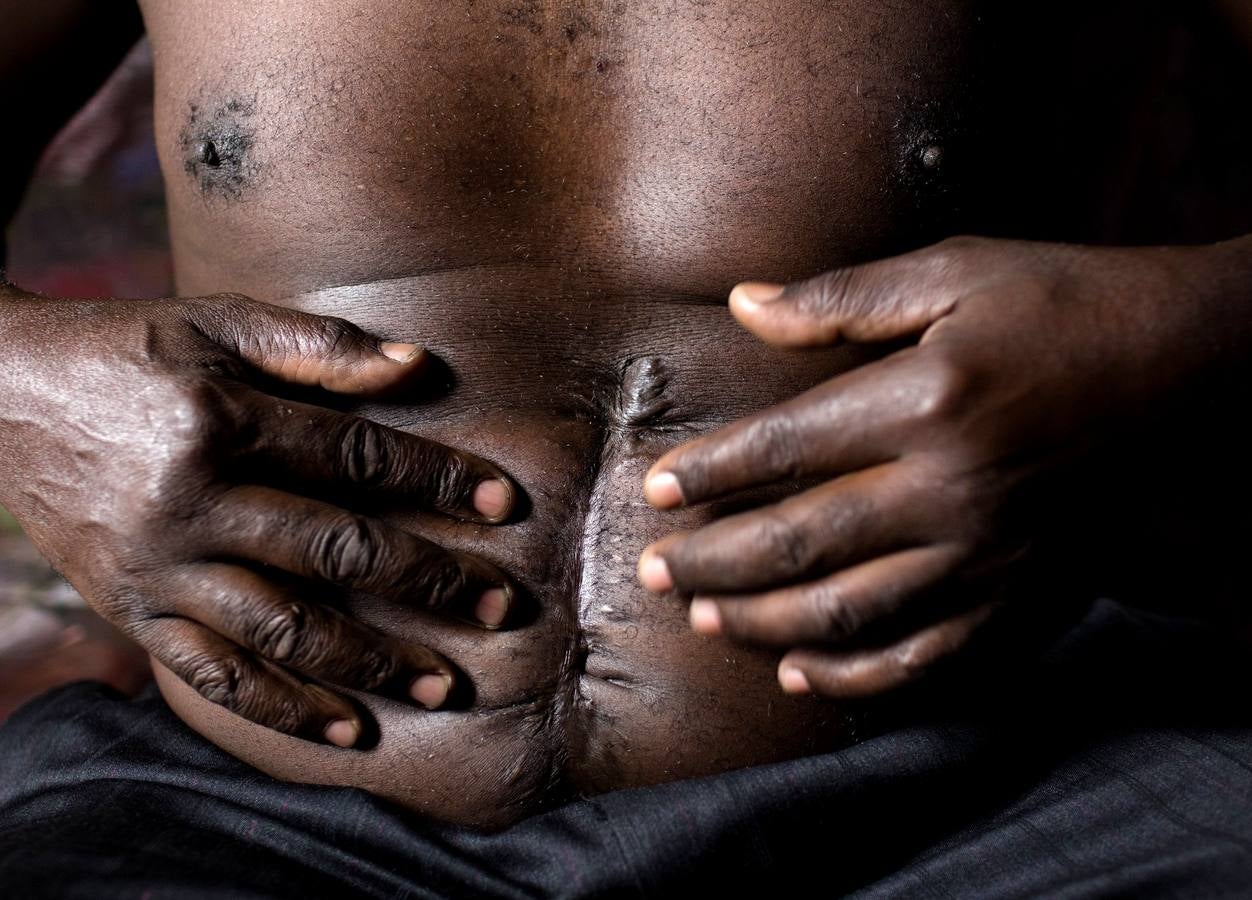 Kenia, el país en conflicto que visita el Papa