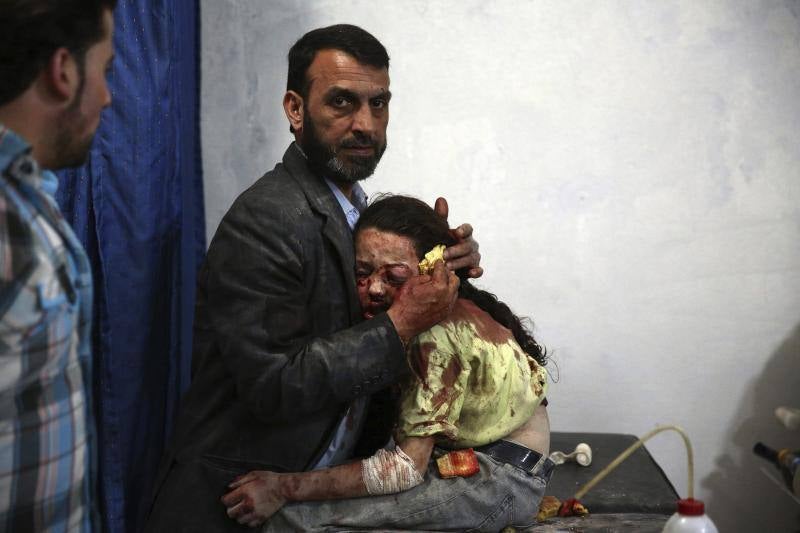 . La fotografía muestra a un niña siria herida que espera abrazada a su padre a ser atendida en un hospital en la ciudad de Douma (Siria). Serie ganadora del segundo premio de Temas de Actualidad.