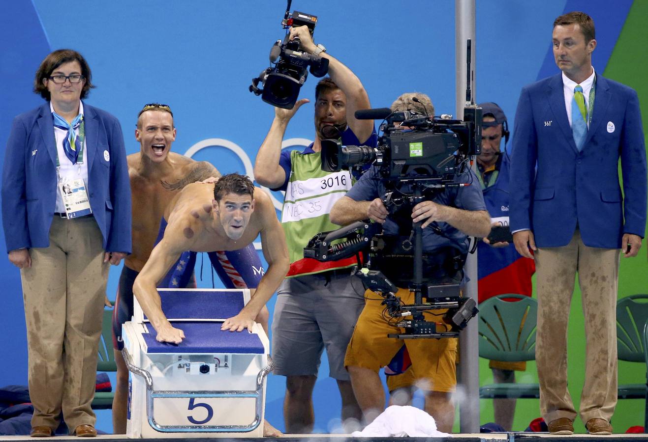 Así son los moratones de Phelps