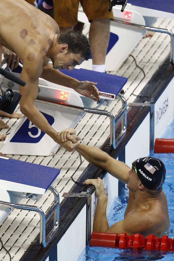 Así son los moratones de Phelps