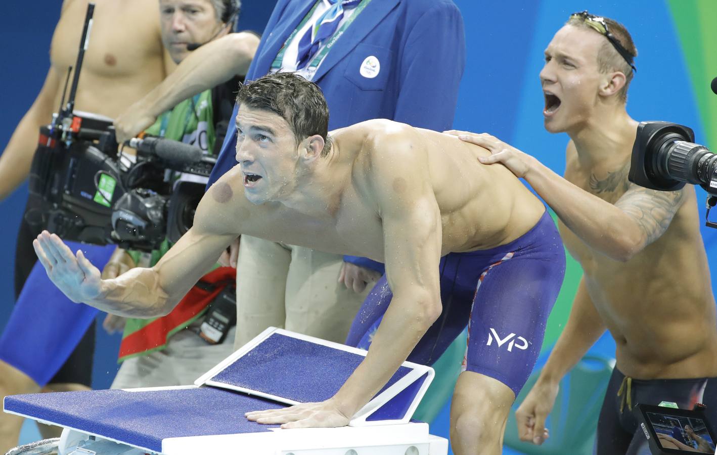 Así son los moratones de Phelps